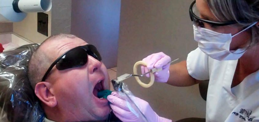 Tucson dentists root canal
